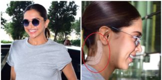 deepika padukone neck surgery1