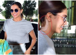 deepika padukone neck surgery1