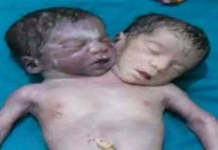 Kanpur news, two headed child, ajab-gajab