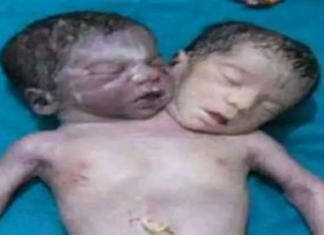 Kanpur news, two headed child, ajab-gajab