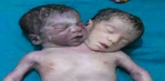 Kanpur news, two headed child, ajab-gajab